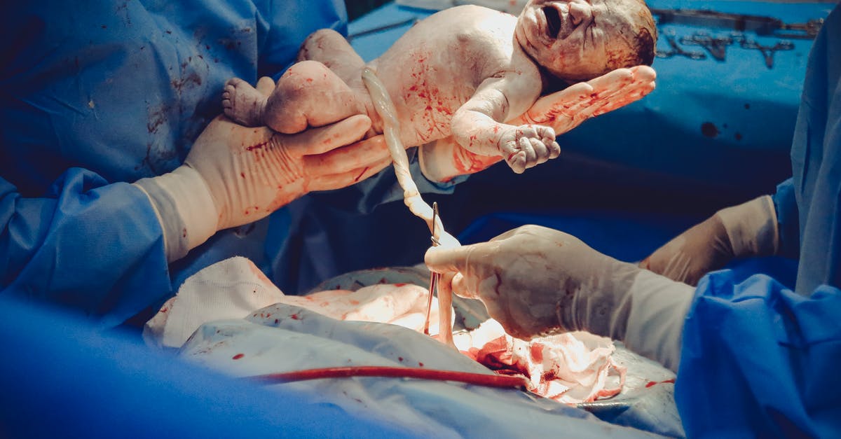 Do doctors outside of US routinely shake hands with their patients and staff? [closed] - New Born Baby