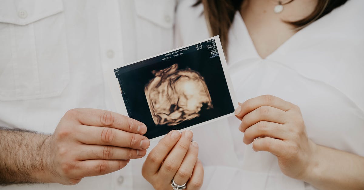 Does my mother need a new passport with my fathers new name to enter the US vith a B2 Visa? [closed] - Couple holding ultrasound picture of baby