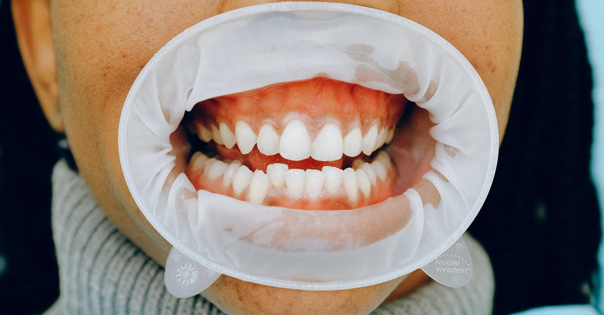 How do I buy an open jaw ticket for this itinerary? - Person With Dental Cheek Retractor How do I buy an open jaw ticket for this itinerary? - Person With Dental Cheek Retractor