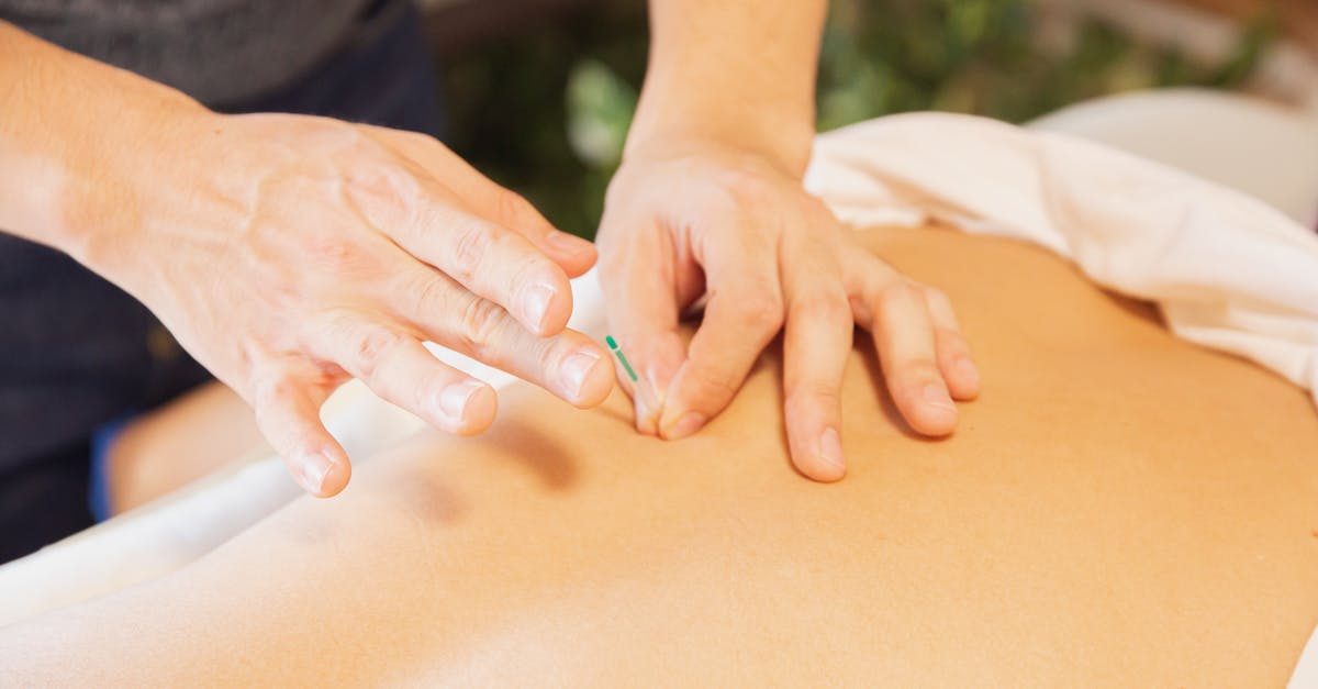 How to apply for a Hong Kong visa from Macao? - From above of crop anonymous man applying needles on back of client during acupuncture procedure How to apply for a Hong Kong visa from Macao? - From above of crop anonymous man applying needles on back of client during acupuncture procedure