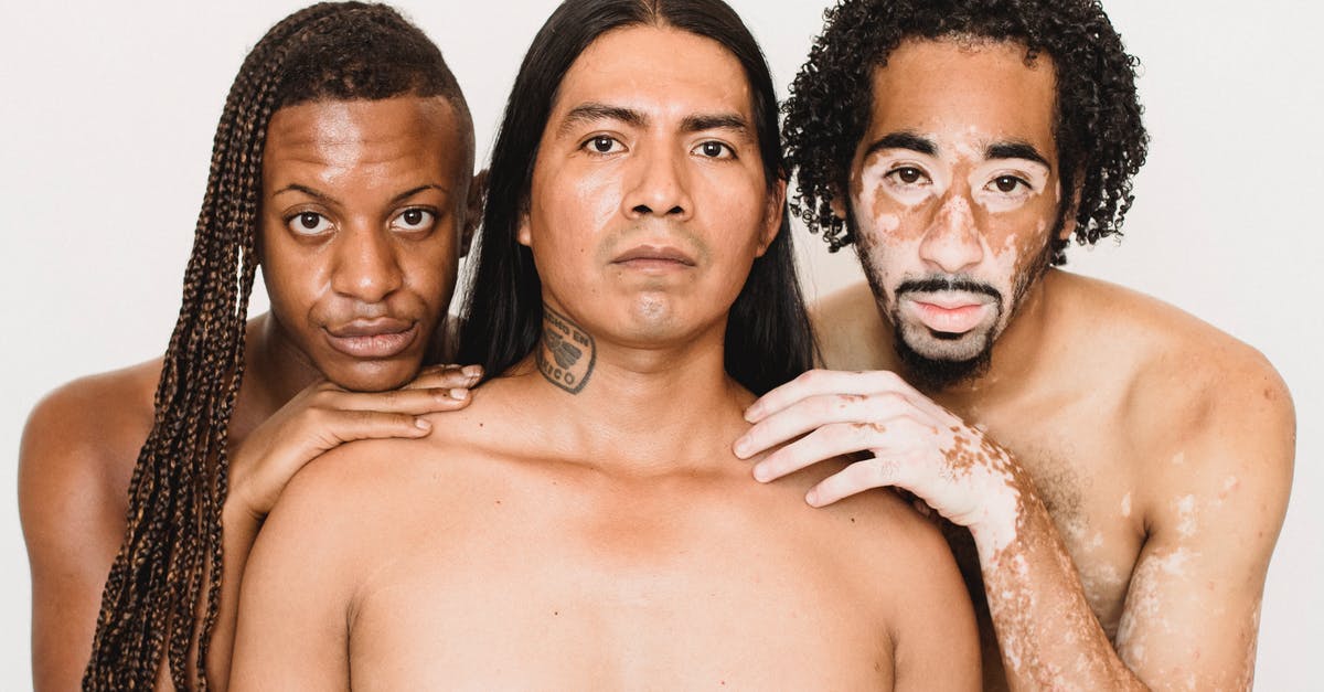 How to decrypt fare conditions? - Young black man with vitiligo skin condition standing close to partner with Afro braids and serious ethnic friend while looking at camera How to decrypt fare conditions? - Young black man with vitiligo skin condition standing close to partner with Afro braids and serious ethnic friend while looking at camera