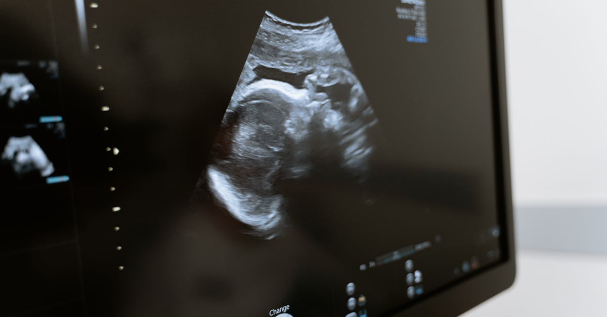 US Healthcare consultation for visitors - Free stock photo of 3d scanning, 3d ultrasound, analysis US Healthcare consultation for visitors - Free stock photo of 3d scanning, 3d ultrasound, analysis
