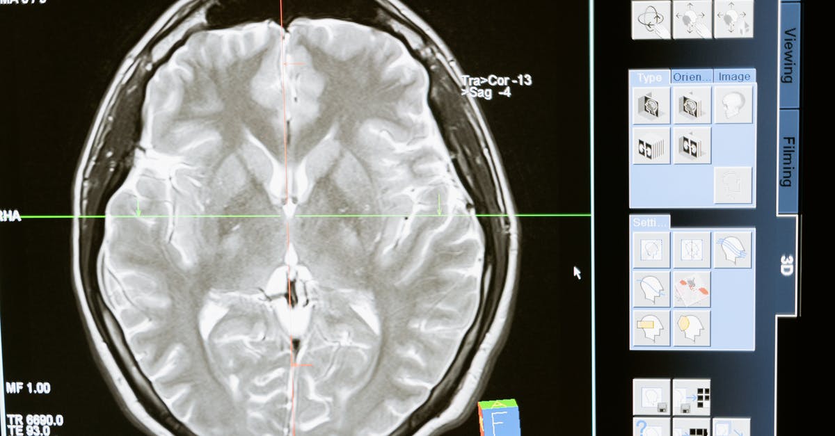 virgin australia 1 PC baggage interpretation - Free stock photo of analysis, anatomy, brain virgin australia 1 PC baggage interpretation - Free stock photo of analysis, anatomy, brain