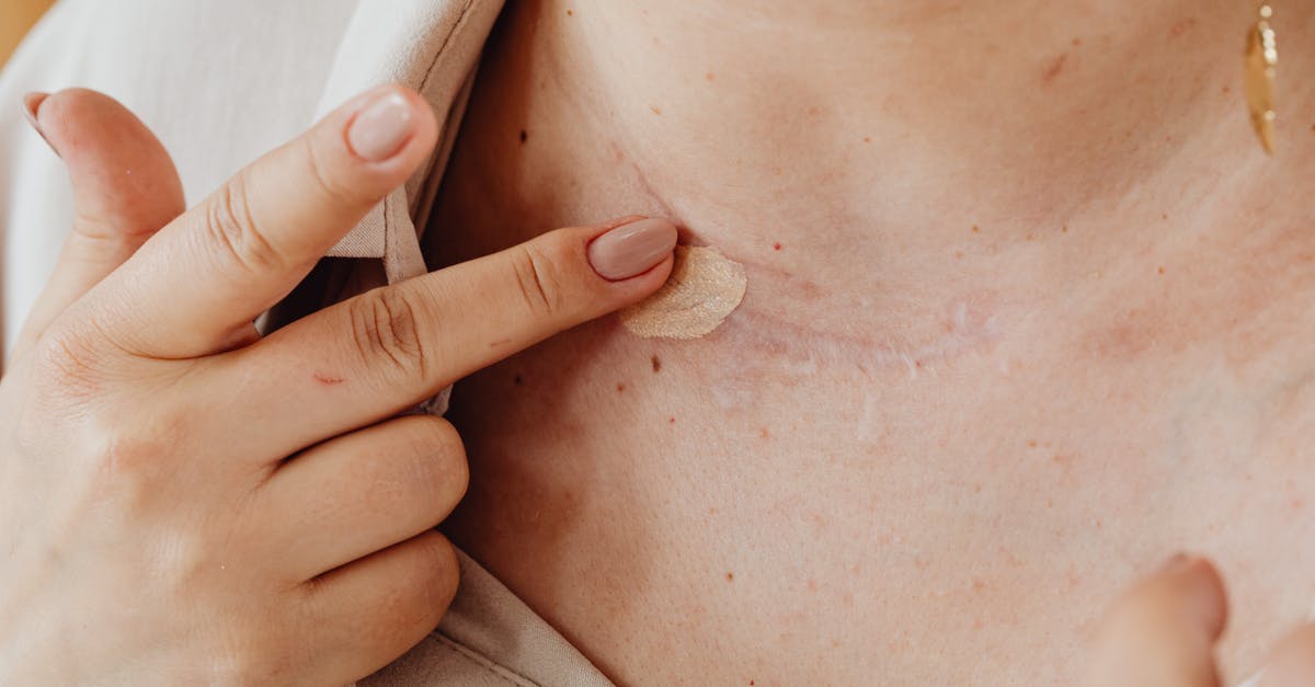 Wi-fi coverage in Taormina and Palermo - A Person Applying Concealer on a Scar Wi-fi coverage in Taormina and Palermo - A Person Applying Concealer on a Scar